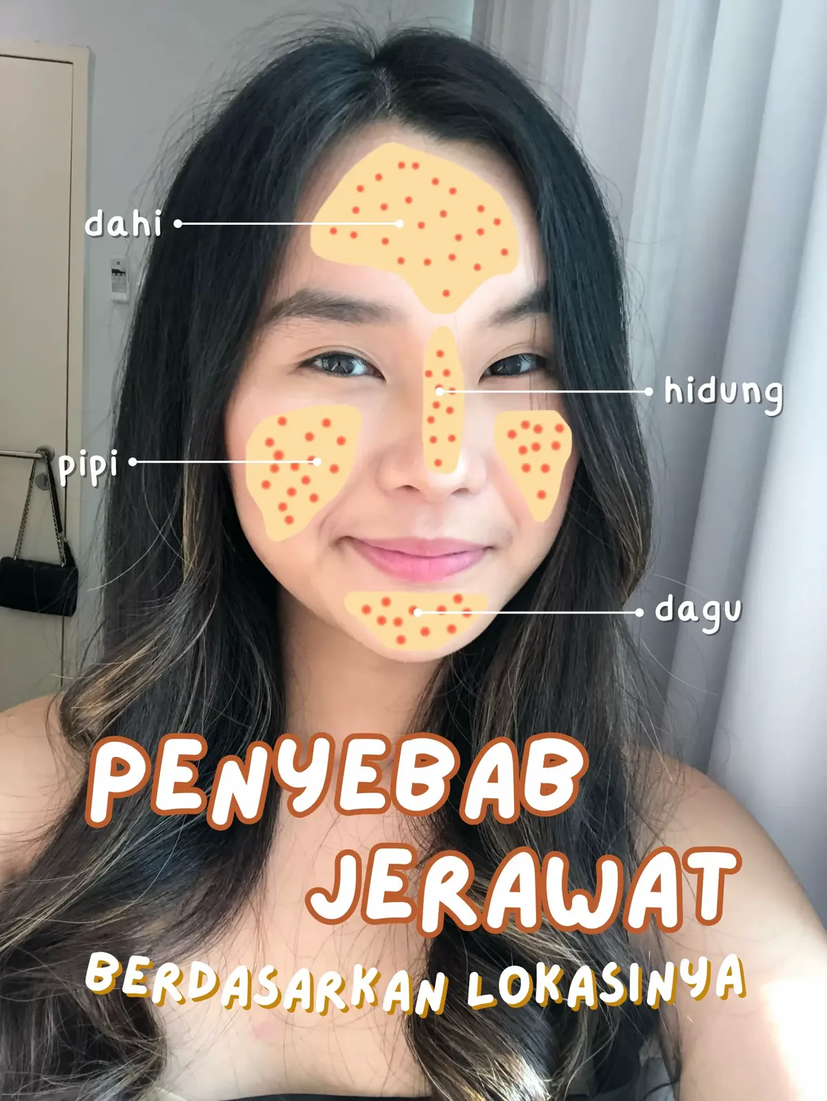jerawat di dahi: Kesalahan Umum yang Justru Memperparah Bruntusan Jidat