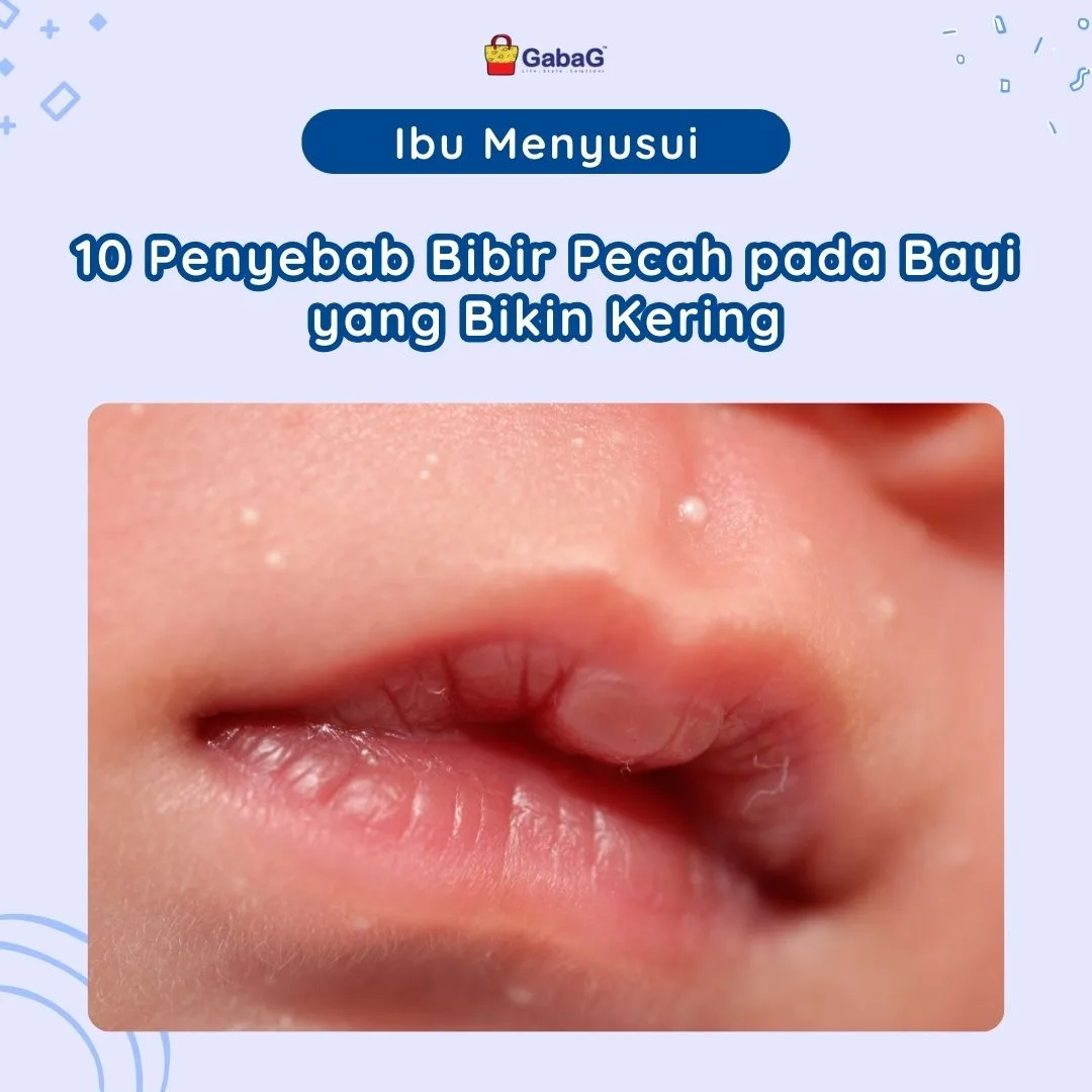 penyebab bibir kering dan pecah