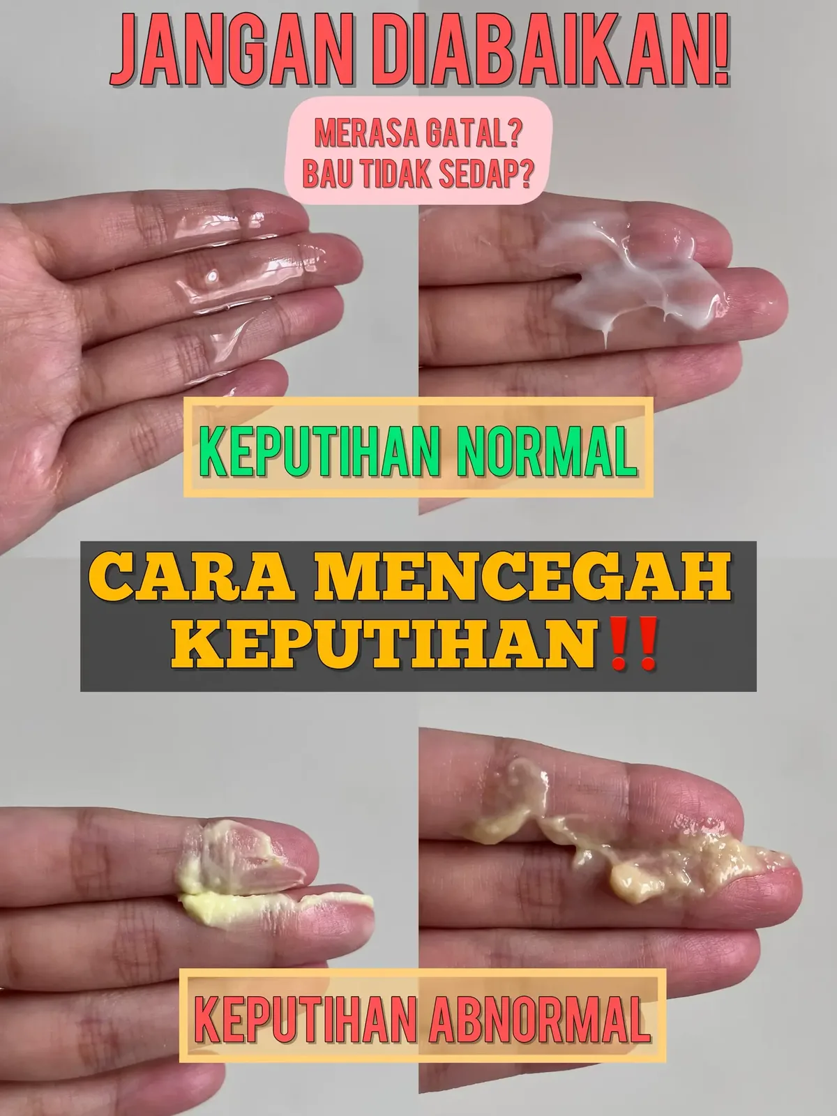 Kenali Perbedaan Keputihan Normal dan Tidak Normal Menurut