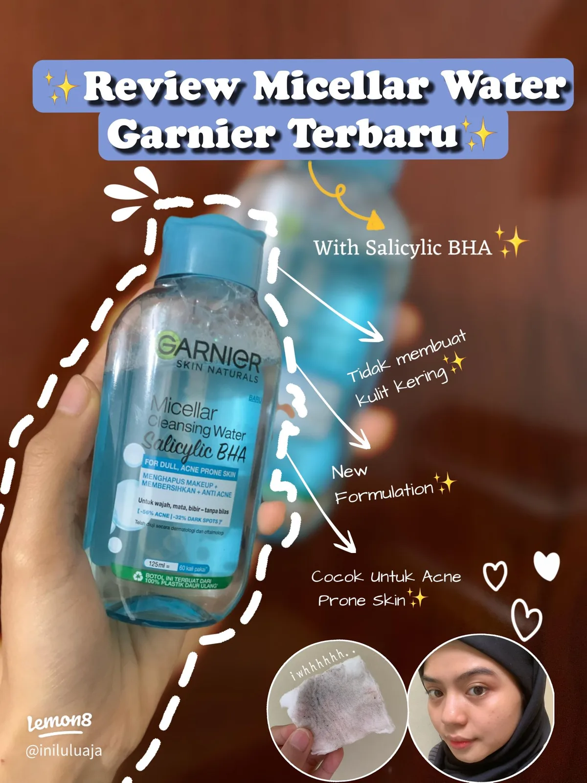 micellar water untuk kulit berjerawat - Membedah Bahan: Apa yang Harus Dicari dan Dihindari