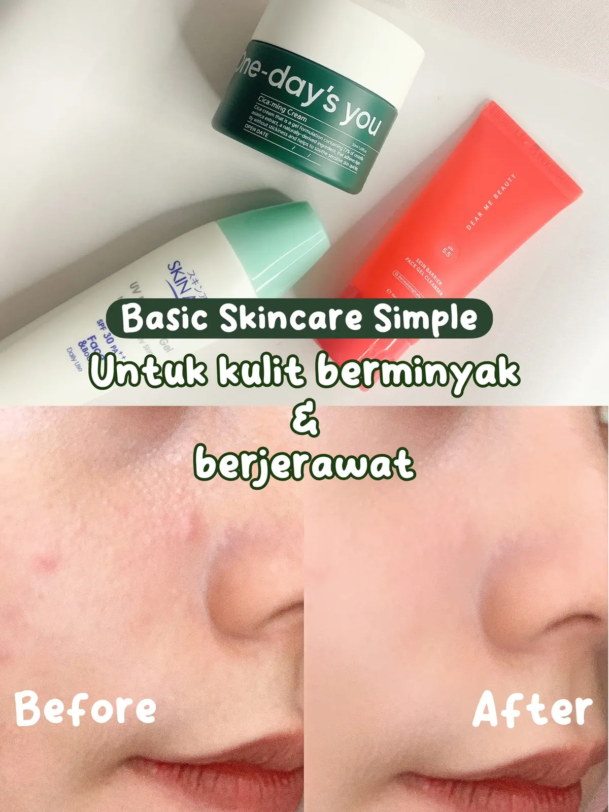 basic skin care