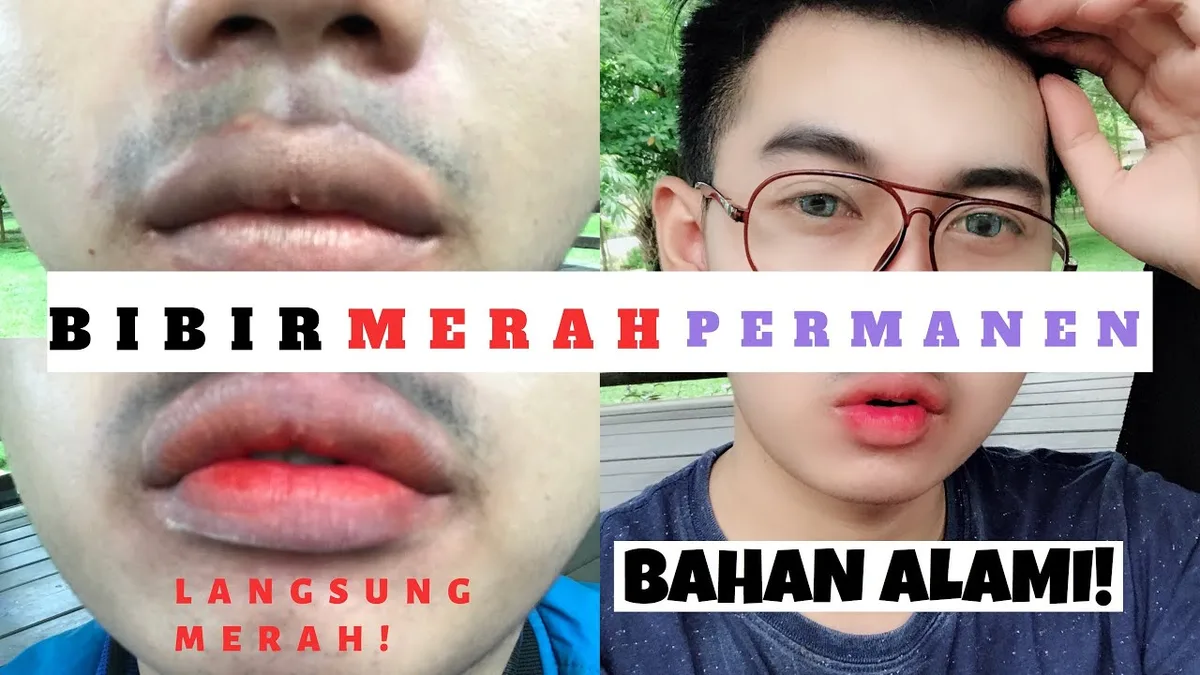 cara merawat bibir hitam