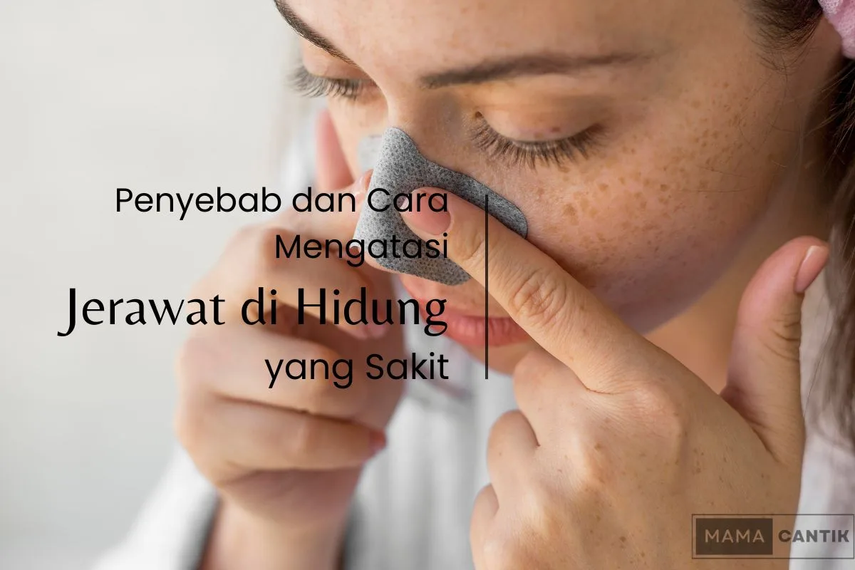 jerawat di hidung