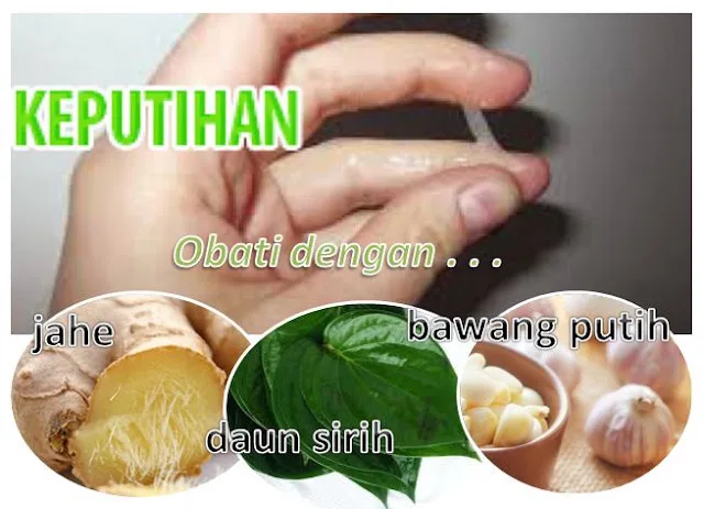 Cara Mengatasi Keputihan Gatal dan Berbau dengan Langkah