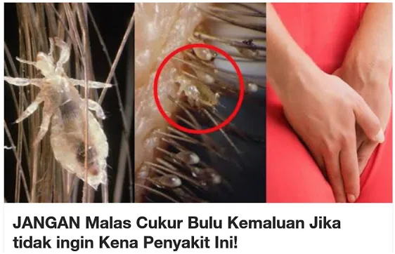 Kesalahan Umum dalam Membersihkan Bulu Kemaluan Sunnah