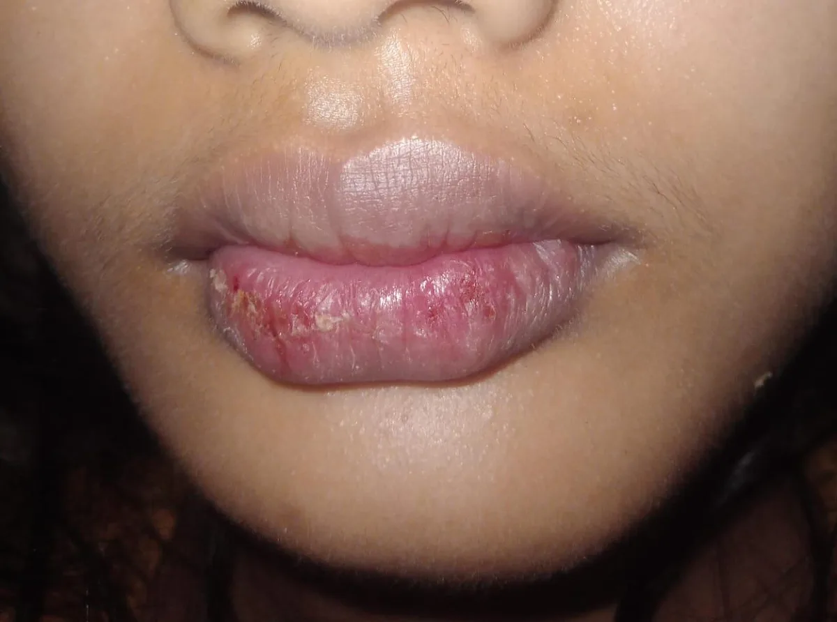 penyebab bibir kering dan pecah - Rutinitas Harian untuk Menjaga Bibir Tetap Sehat