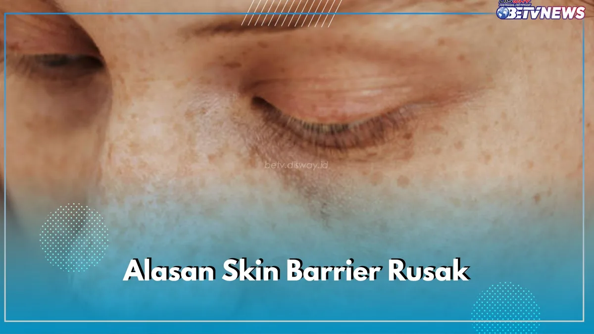 skin barrier rusak: Langkah Lanjutan dan Konteks Topik yang Lebih Luas