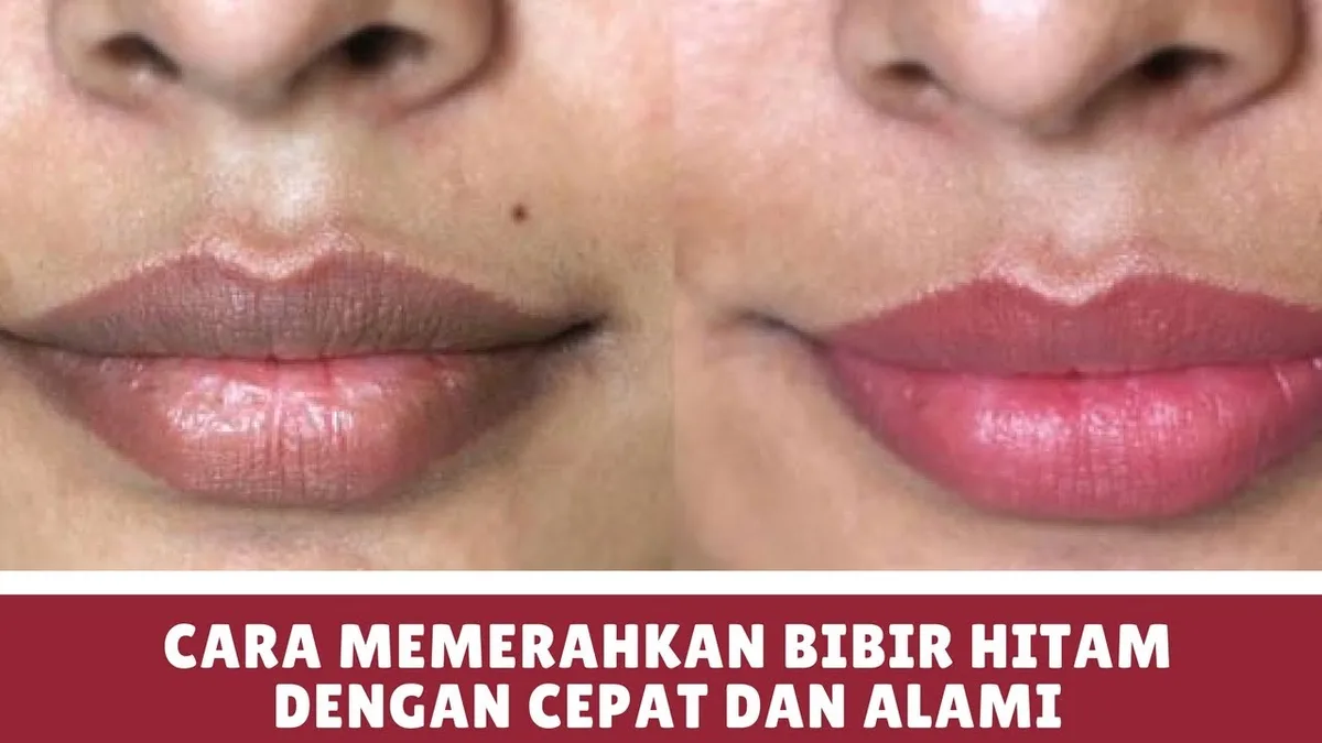 cara merawat bibir hitam: Kesalahan yang Sering Terjadi saat Mencoba Cara Merawat