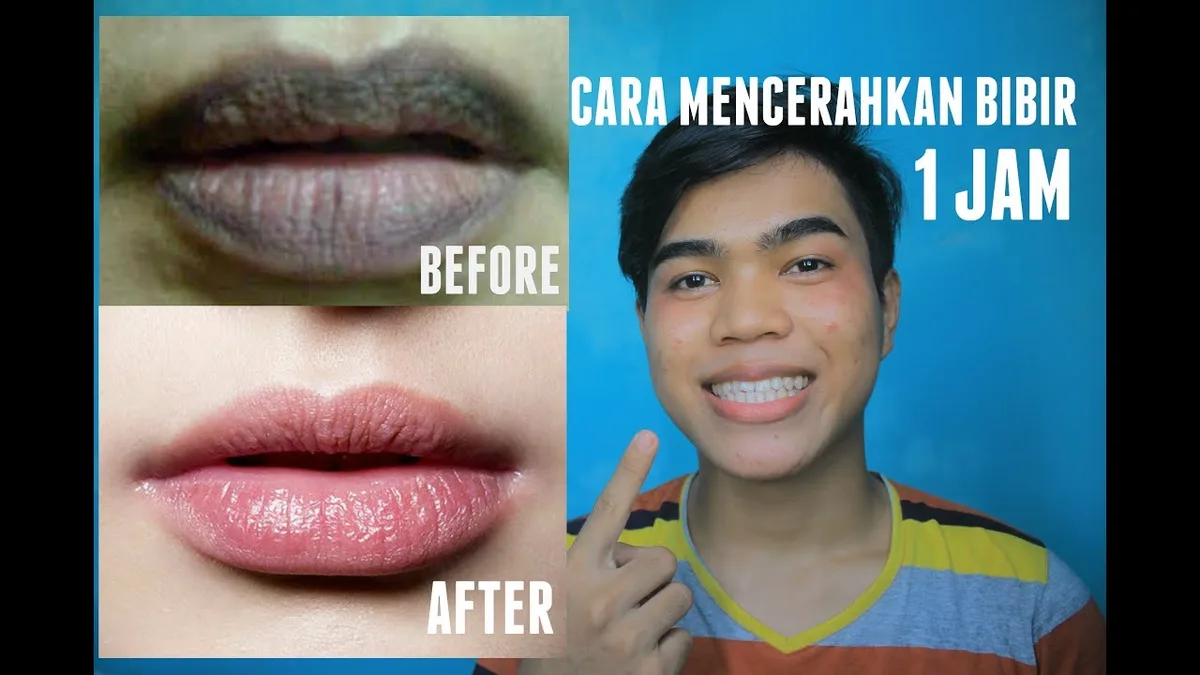 cara merawat bibir hitam