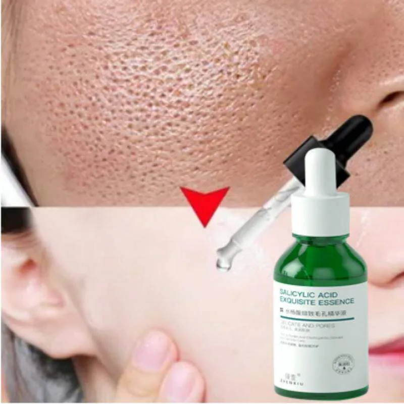 salicylic acid untuk jerawat - Mengapa Kadar pH dan Formulasi Menentukan Hasil Salicylic
