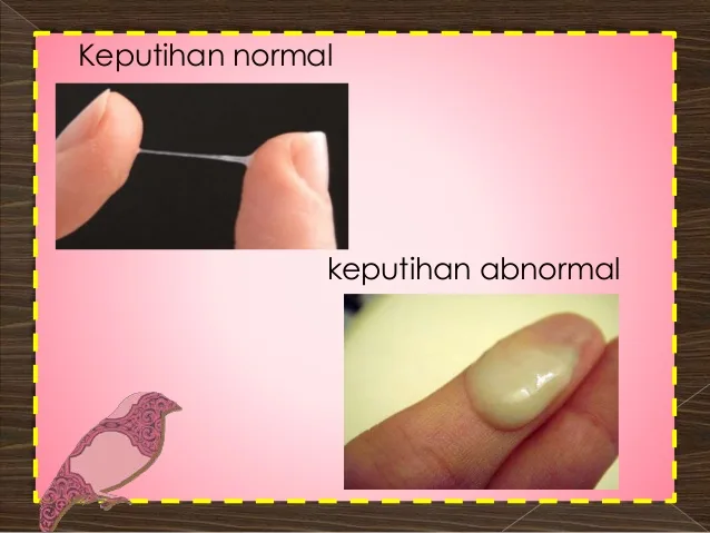 keputihan normal dan tidak normal: Keputihan Normal: Ciri-Ciri yang Justru Menandakan Tubuh