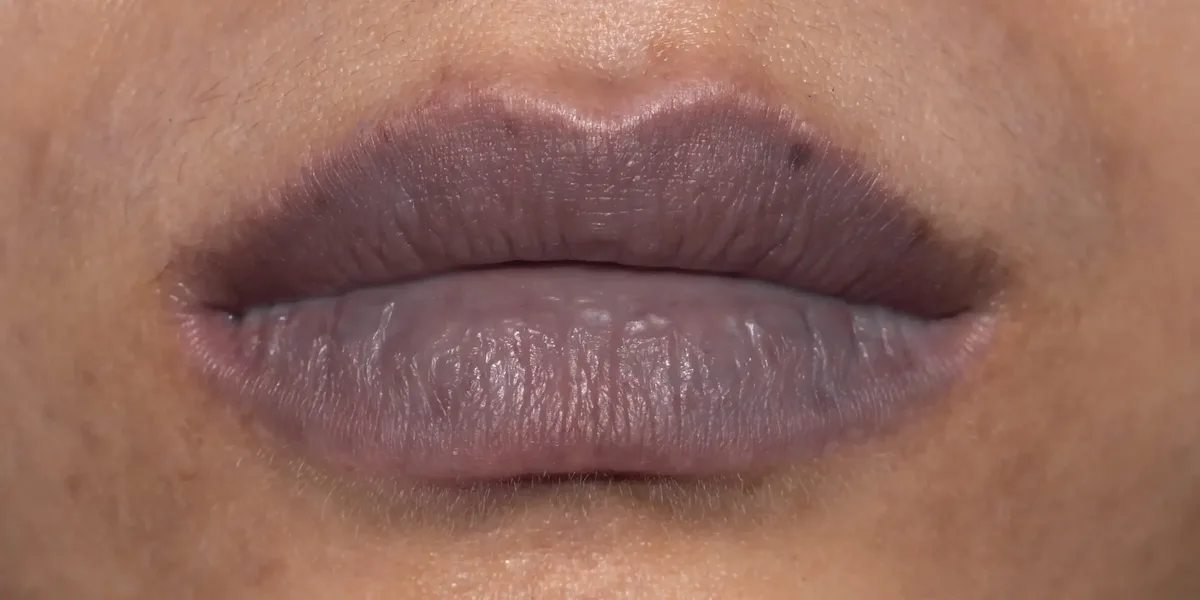cara merawat bibir hitam