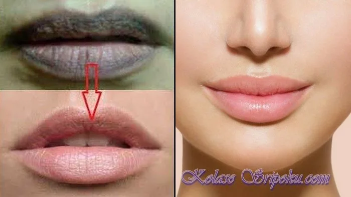 cara merawat bibir hitam