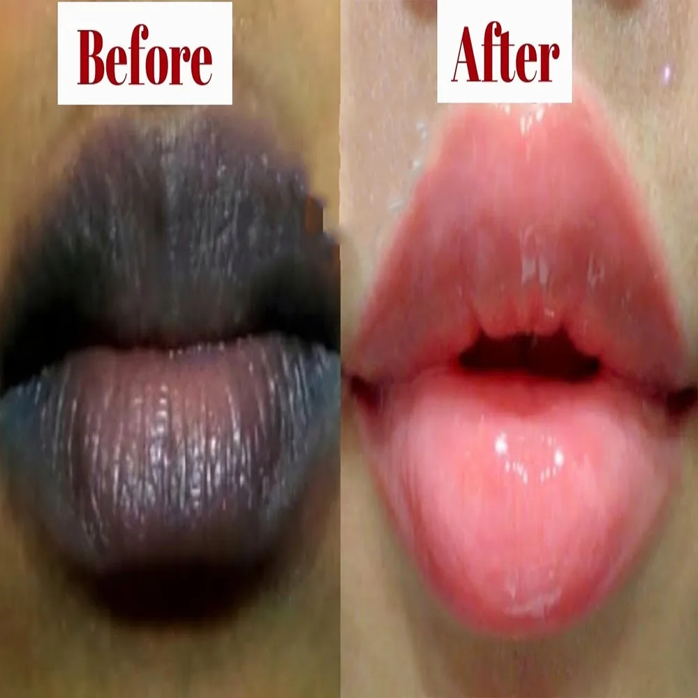 cara merawat bibir hitam - Pertanyaan yang Sering Muncul Seputar Madu untuk Bibir Hitam