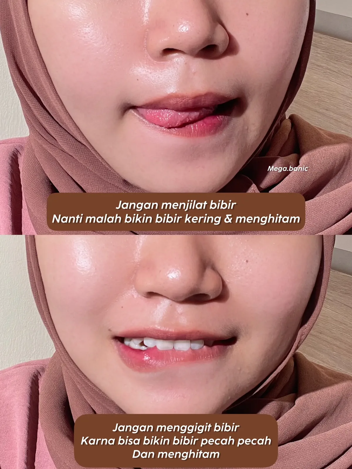 cara merawat bibir hitam: Tabel Perbandingan Lima Metode Madu untuk Bibir Hitam