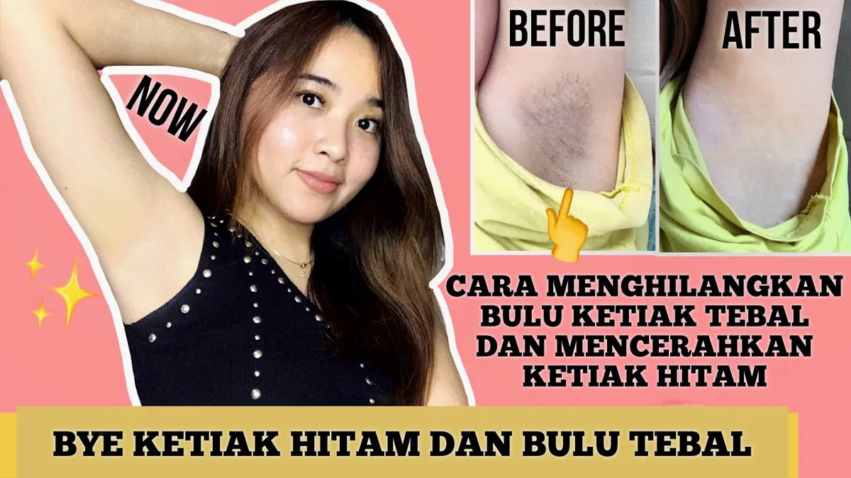 Enam Cara Mencerahkan Ketiak Hitam Secara Alami yang Bisa