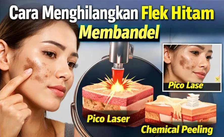 menghilangkan flek hitam di wajah - Berapa Lama Hasilnya Terlihat dan Bagaimana Merawatnya?