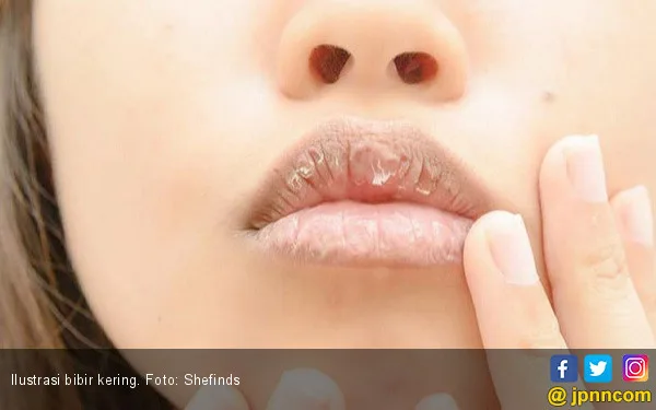 penyebab bibir kering dan pecah