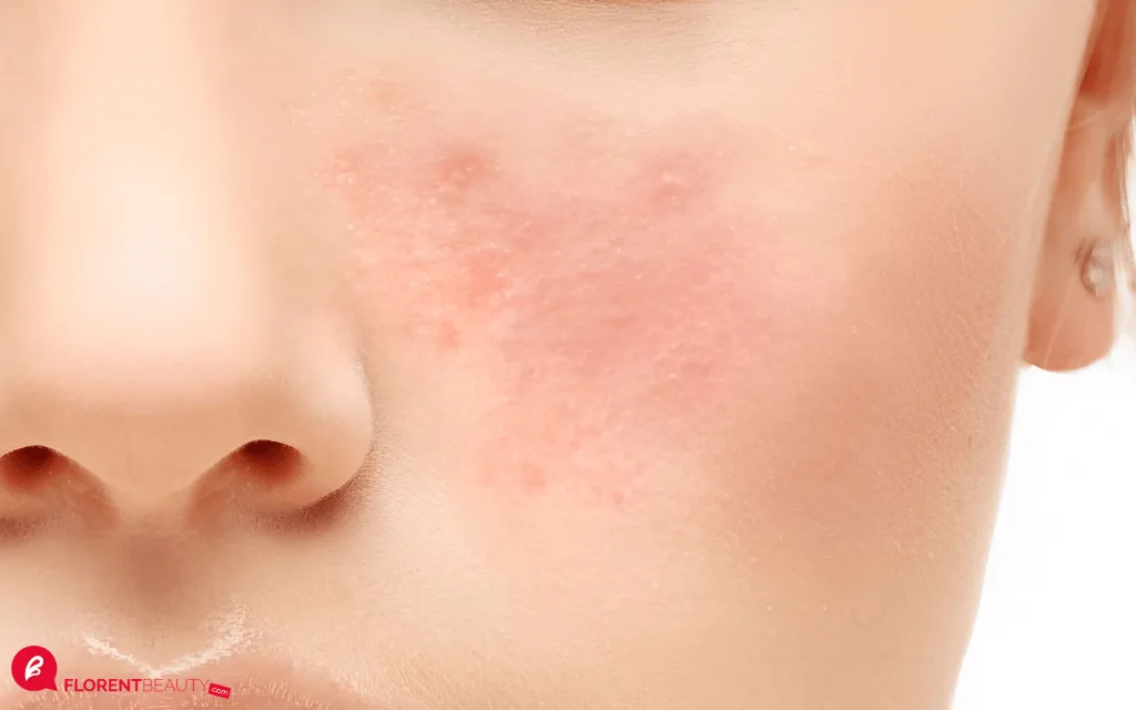 skin barrier rusak: Skincare Perbaiki Skin Barrier: Panduan Memilih Produk yang