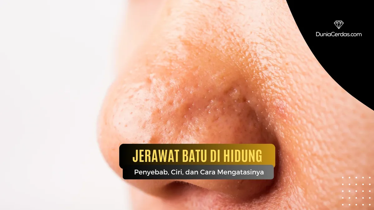 Kesalahan yang Membuat Jerawat di Hidung Mudah Berbekas