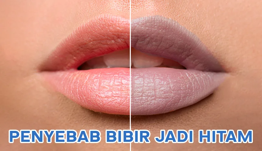 cara merawat bibir hitam - Meletakkan Madu dalam Klaster Perawatan Bibir yang Lebih