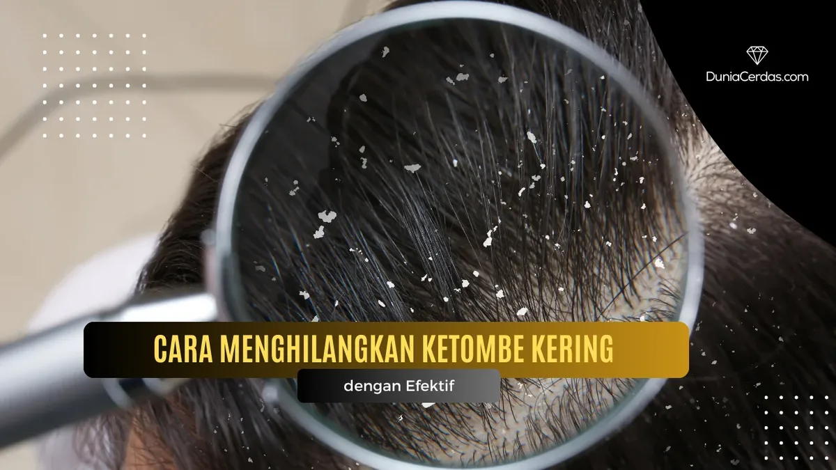 cara menghilangkan ketombe - Minyak Zaitun untuk Ketombe: Ramuan Klasik yang Terbukti