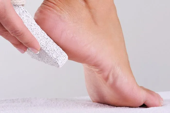 mengatasi tumit kaki pecah pecah
