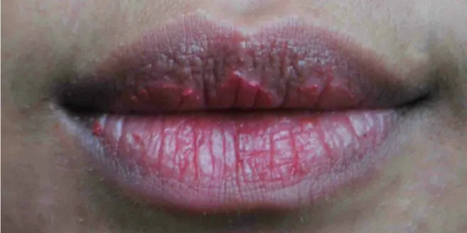 cara merawat bibir hitam: Merangkai Kebiasaan: Rencana Sederhana Satu Bulan