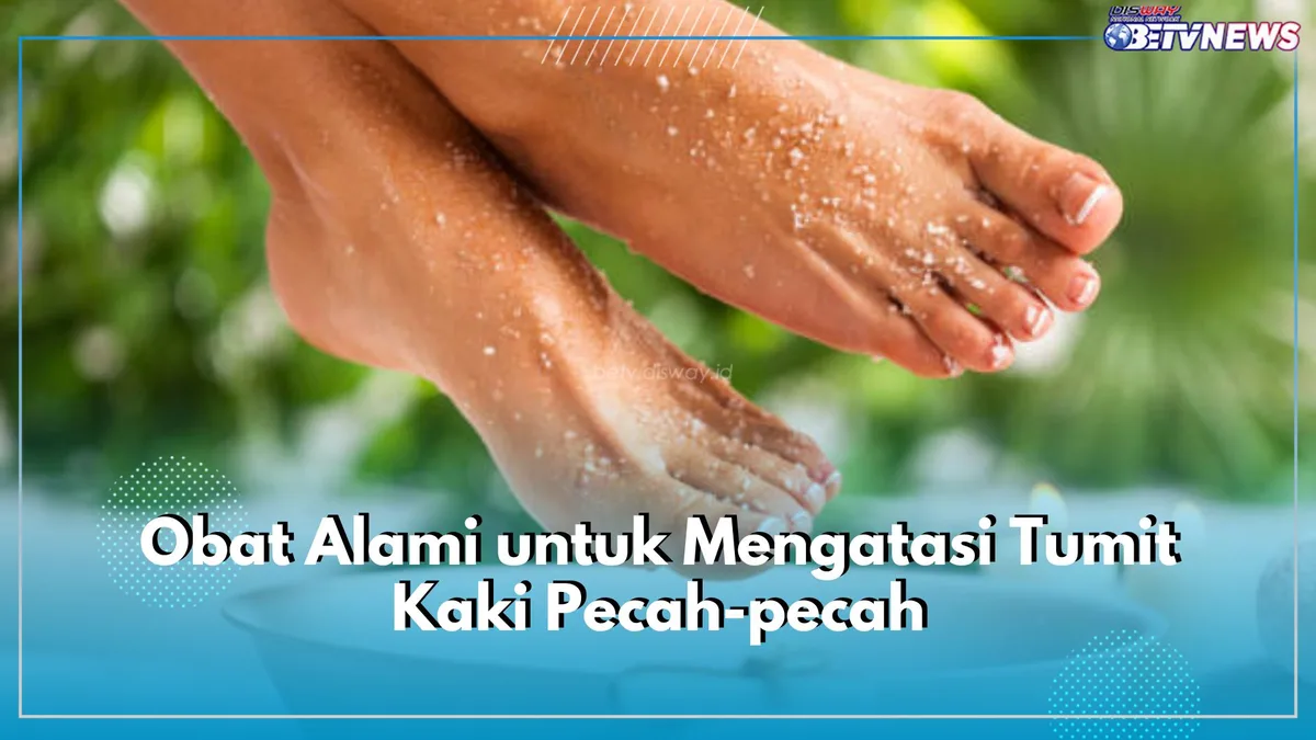 mengatasi tumit kaki pecah pecah
