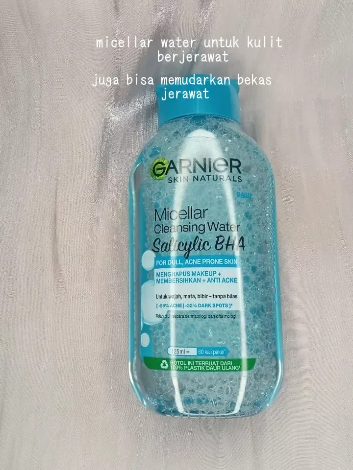 Cara Memilih Micellar Water untuk Kulit Berjerawat dan