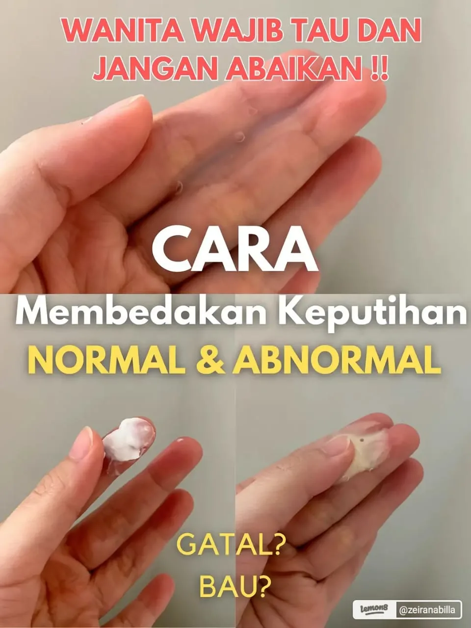 mengatasi keputihan gatal dan berbau