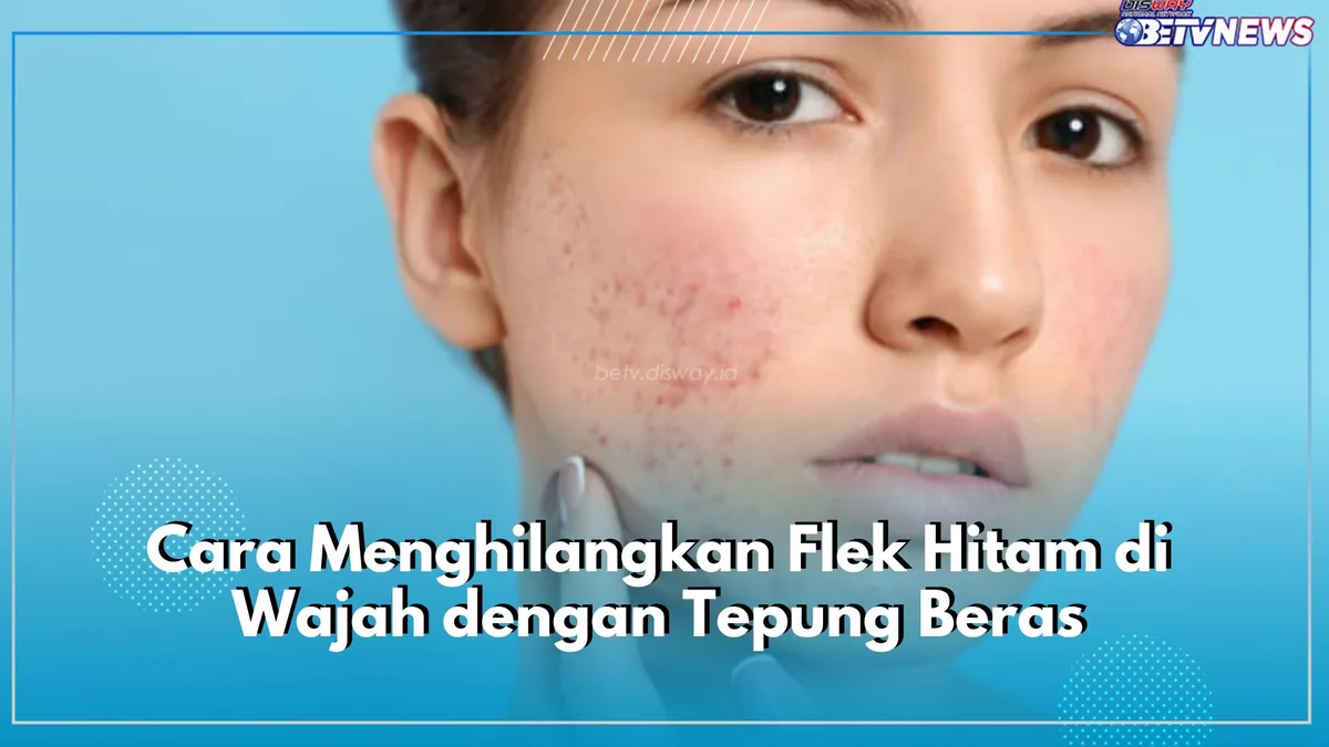 menghilangkan flek hitam di wajah