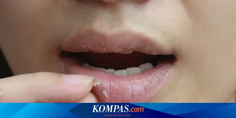 penyebab bibir kering dan pecah