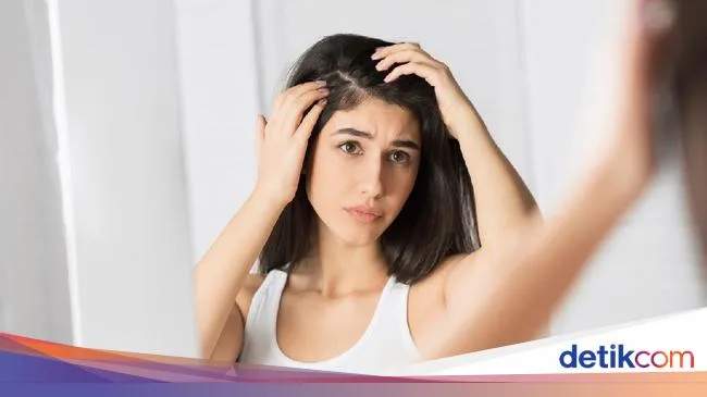 cara menghilangkan ketombe