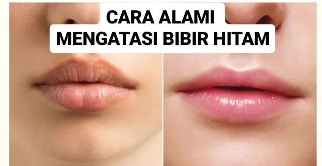 cara merawat bibir hitam