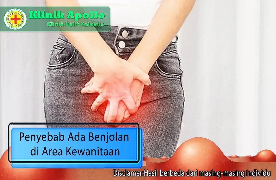 merawat area kewanitaan sesuai sunnah: Peran Edukasi Keluarga dalam Merawat Area Kewanitaan Sesuai