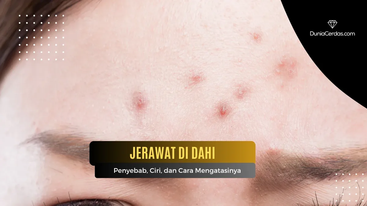Kenapa Jerawat di Dahi Mudah Muncul? Pahami Dulu Pola