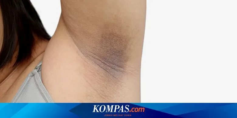 cara mencerahkan ketiak hitam