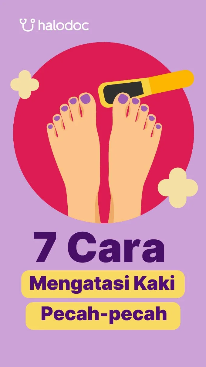 mengatasi tumit kaki pecah pecah