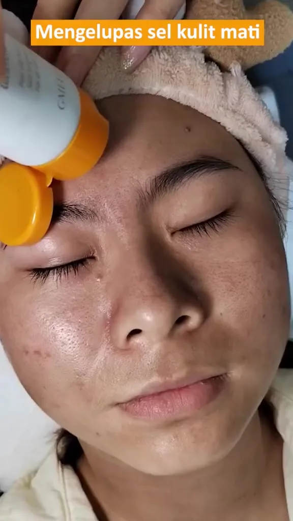eksfoliasi wajah - Peeling Wajah Alami: Pilihan Bahan Rumahan yang Aman