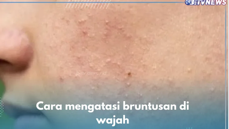 bruntusan di wajah: Rutinitas Harian yang Menjaga Hasil Setelah 7 Hari