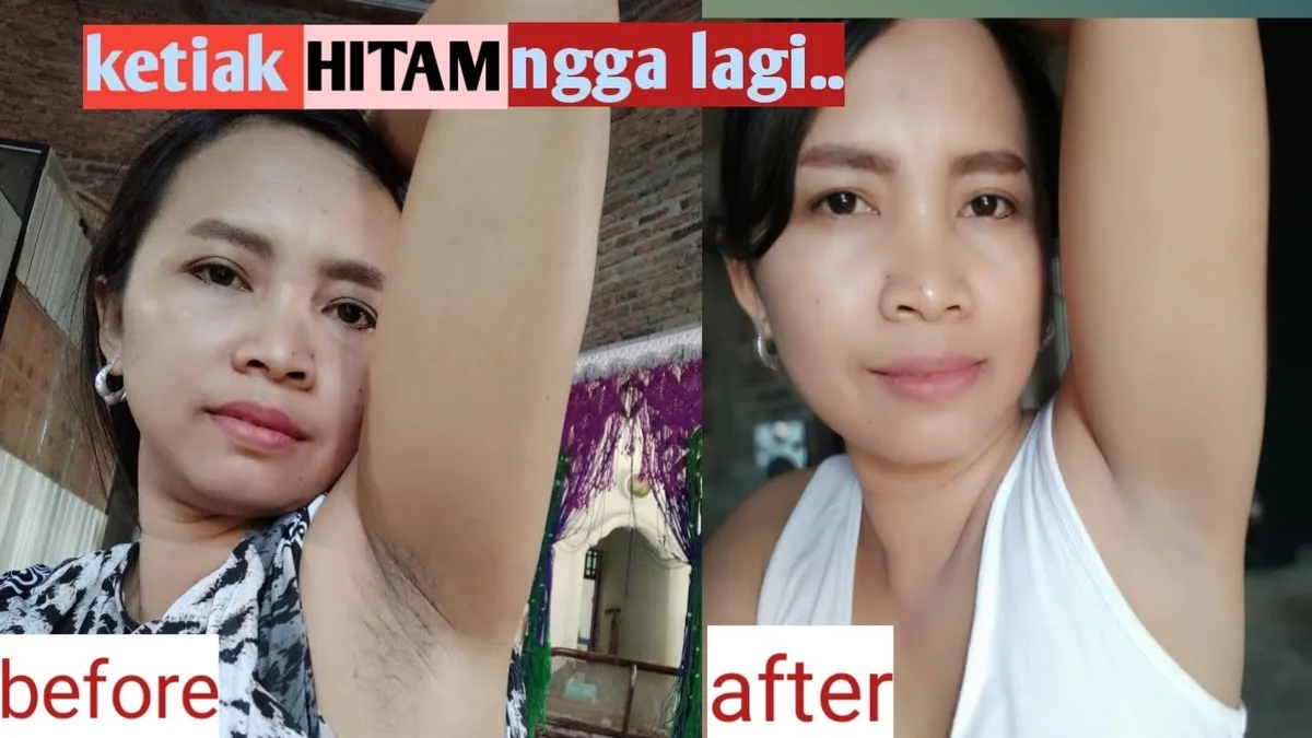 Kriteria Cara Mencerahkan Ketiak Hitam yang Aman dan Bebas